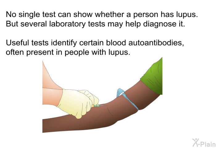 No single test can show whether a person has lupus. But several laboratory tests may help diagnose it. Useful tests identify certain blood autoantibodies, often present in people with lupus.
