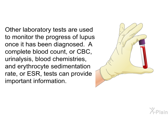 Other laboratory tests are used to monitor the progress of lupus once it has been diagnosed. A complete blood count, or CBC, urinalysis, blood chemistries, and erythrocyte sedimentation rate, or ESR, tests can provide important information.