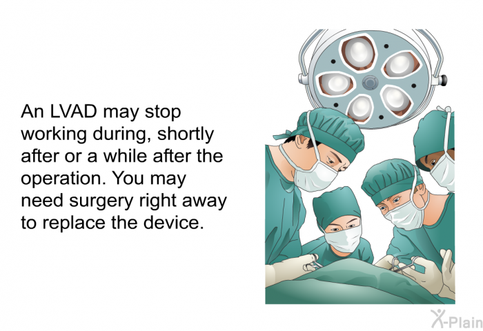An LVAD may stop working during, shortly after or a while after the operation. You may need surgery right away to replace the device.
