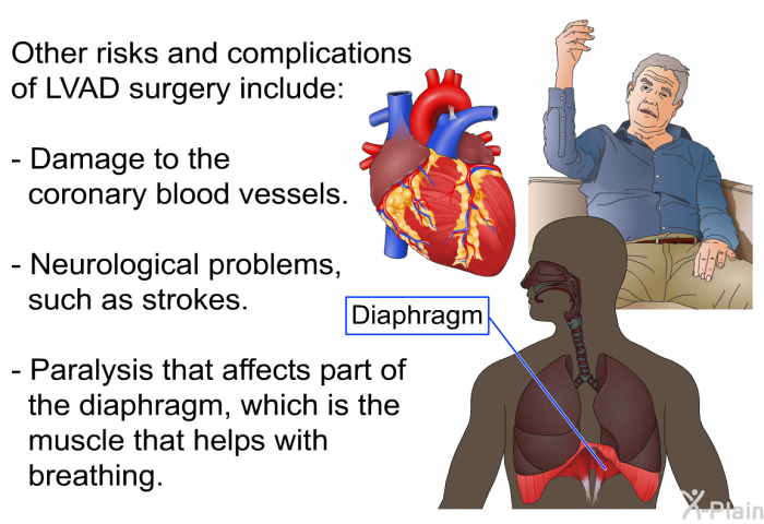 Other risks and complications of LVAD surgery include:  Damage to the coronary blood vessels. Neurological problems, such as strokes. Paralysis that affects part of the diaphragm, which is the muscle that helps with breathing.