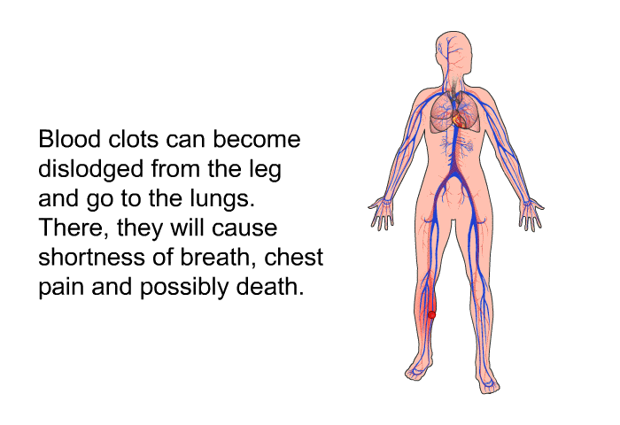 Blood clots can become dislodged from the leg and go to the lungs. There, they will cause shortness of breath, chest pain and possibly death.
