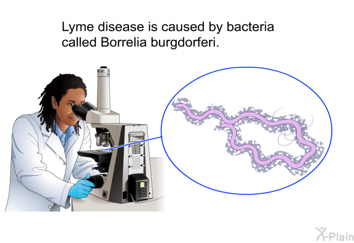 Lyme disease is caused by bacteria called <I>Borrelia burgdorferi</I>.
