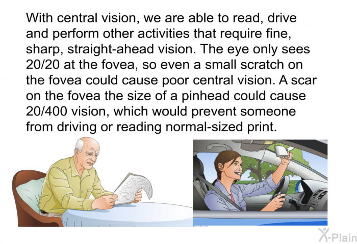 With central vision, we are able to read, drive and perform other activities that require fine, sharp, straight-ahead vision. The eye only sees 20/20 at the fovea, so even a small scratch on the fovea could cause poor central vision. A scar on the fovea the size of a pinhead could cause 20/400 vision, which would prevent someone from driving or reading normal-sized print.