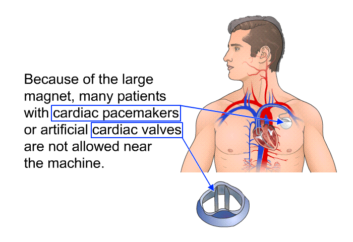 Because of the large magnet, many patients with cardiac pacemakers or artificial cardiac valves are not allowed near the machine.