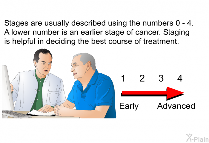 Stages are usually described using the numbers 0 - 4. A lower number is an earlier stage of cancer. Staging is helpful in deciding the best course of treatment.