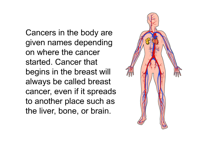 Cancers in the body are given names depending on where the cancer started. Cancer that begins in the breast will always be called breast cancer, even if it spreads to another place such as the liver, bone, or brain.