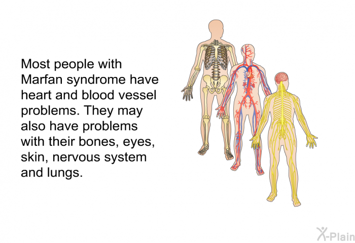 Most people with Marfan syndrome have heart and blood vessel problems. They may also have problems with their bones, eyes, skin, nervous system and lungs.