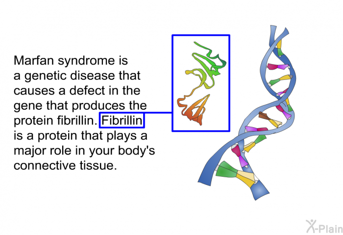 Marfan syndrome is a genetic disease that causes a defect in the gene that produces the protein fibrillin. Fibrillin is a protein that plays a major role in your body's connective tissue.
