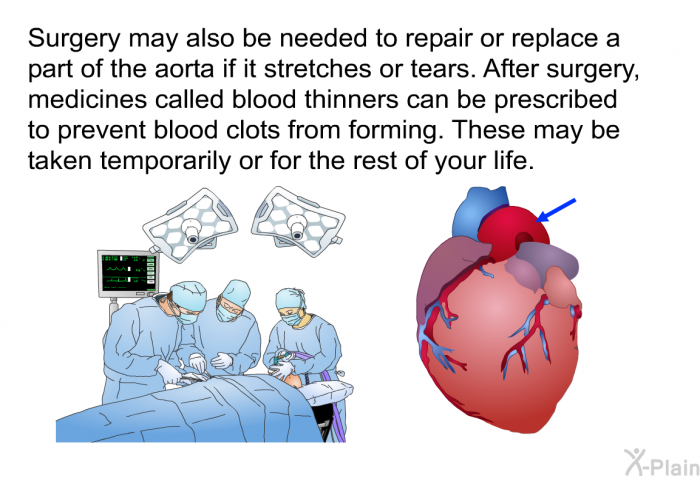 Surgery may also be needed to repair or replace a part of the aorta if it stretches or tears. After surgery, medicines called blood thinners can be prescribed to prevent blood clots from forming. These may be taken temporarily or for the rest of your life.