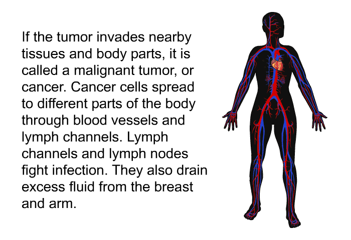 If the tumor invades nearby tissues and body parts, it is called a malignant tumor, or cancer. Cancer cells spread to different parts of the body through blood vessels and lymph channels. Lymph channels and lymph nodes fight infection. They also drain excess fluid from the breast and arm.