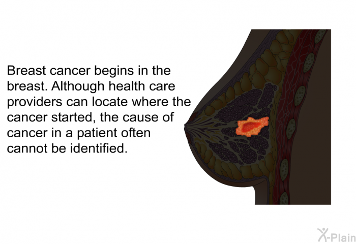 Breast cancer begins in the breast. Although health care providers can locate where the cancer started, the cause of cancer in a patient often cannot be identified.