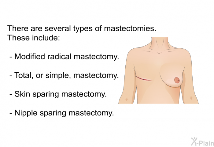 There are several types of mastectomies. These include:  Modified radical mastectomy. Total, or simple, mastectomy. Skin sparing mastectomy. Nipple sparing mastectomy.
