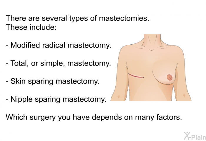 There are several types of mastectomies. These include:  Modified radical mastectomy. Total, or simple, mastectomy. Skin sparing mastectomy. Nipple sparing mastectomy.  
 Which surgery you have depends on many factors.
