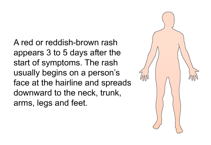 A red or reddish-brown rash appears 3 to 5 days after the start of symptoms. The rash usually begins on a person's face at the hairline and spreads downward to the neck, trunk, arms, legs and feet.