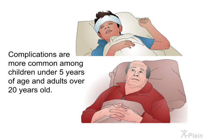 Complications are more common among children under 5 years of age and adults over 20 years old.