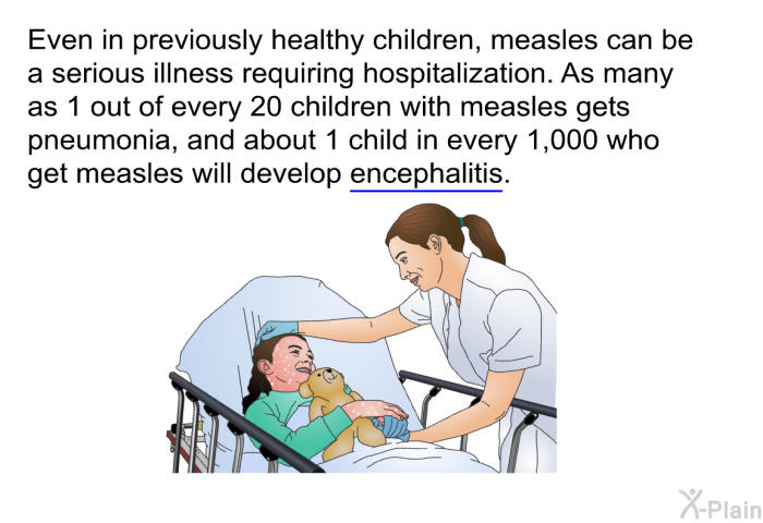 Even in previously healthy children, measles can be a serious illness requiring hospitalization. As many as 1 out of every 20 children with measles gets pneumonia, and about 1 child in every 1,000 who get measles will develop encephalitis.