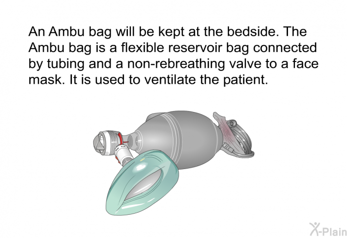 An Ambu bag will be kept at the bedside. The Ambu bag is a flexible reservoir bag connected by tubing and a non-rebreathing valve to a face mask. It is used to ventilate the patient.