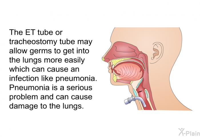 The ET tube or tracheostomy tube may allow germs to get into the lungs more easily which can cause an infection like pneumonia. Pneumonia is a serious problem and can cause damage to the lungs.
