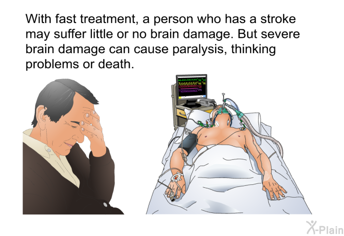 With fast treatment, a person who has a stroke may suffer little or no brain damage. But severe brain damage can cause paralysis, thinking problems or death.