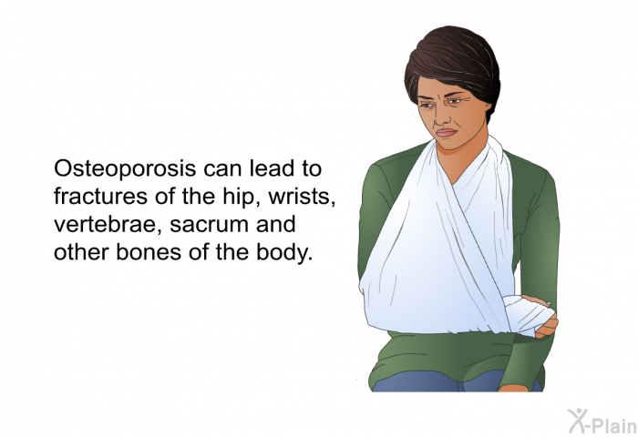 Osteoporosis can lead to fractures of the hip, wrists, vertebrae, sacrum and other bones of the body.