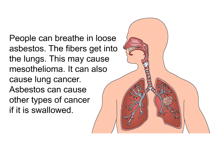 People can breathe in loose asbestos. The fibers get into the lungs. This may cause mesothelioma. It can also cause lung cancer. Asbestos can cause other types of cancer if it is swallowed.