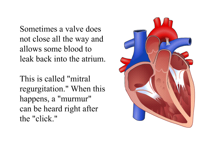 Sometimes a valve does not close all the way and allows some blood to leak back into the atrium. This is called “mitral regurgitation.” When this happens, a “murmur” can be heard right after the “click.”