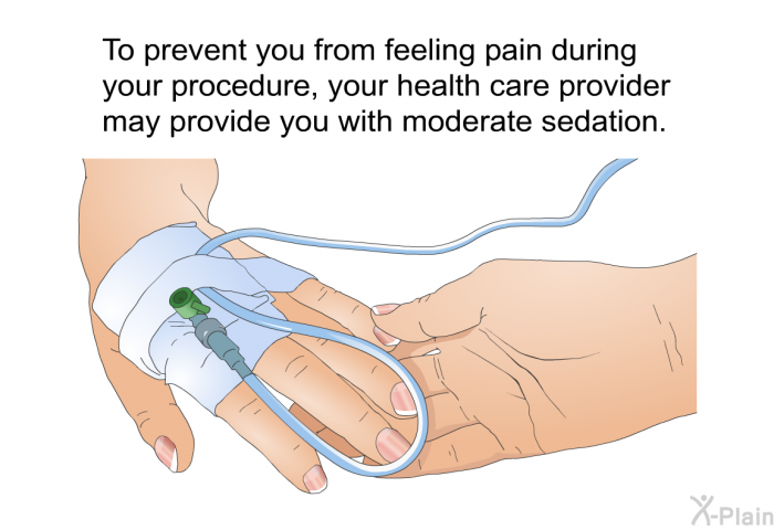 To prevent you from feeling pain during your procedure, your health care provider may provide you with moderate sedation.