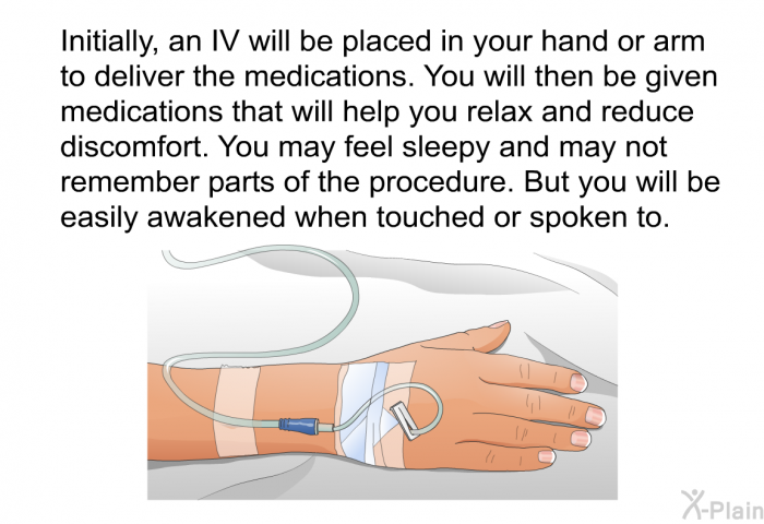 Initially, an IV will be placed in your hand or arm to deliver the medications. You will then be given medications that will help you relax and reduce discomfort. You may feel sleepy and may not remember parts of the procedure. But you will be easily awakened when touched or spoken to.