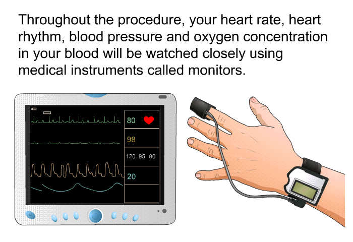 Throughout the procedure, your heart rate, heart rhythm, blood pressure and oxygen concentration in your blood will be watched closely using medical instruments called monitors.