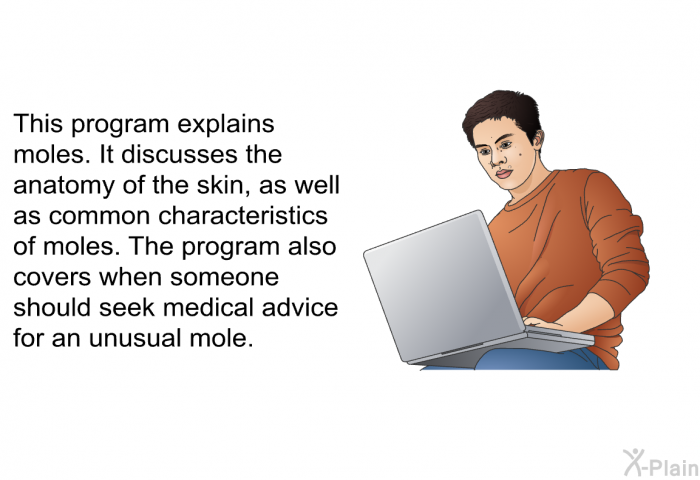 This health information explains moles. It discusses the anatomy of the skin, as well as common characteristics of moles. The program also covers when someone should seek medical advice for an unusual mole.