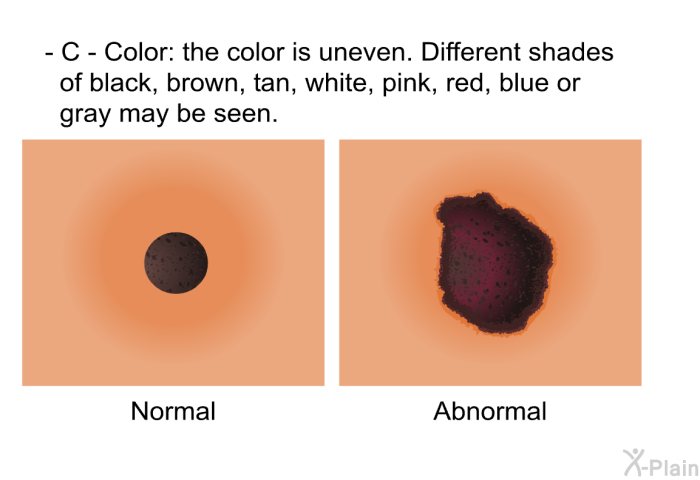 <B>C - Color:</B> the color is uneven. Different shades of black, brown, tan, white, pink, red, blue or gray may be seen.