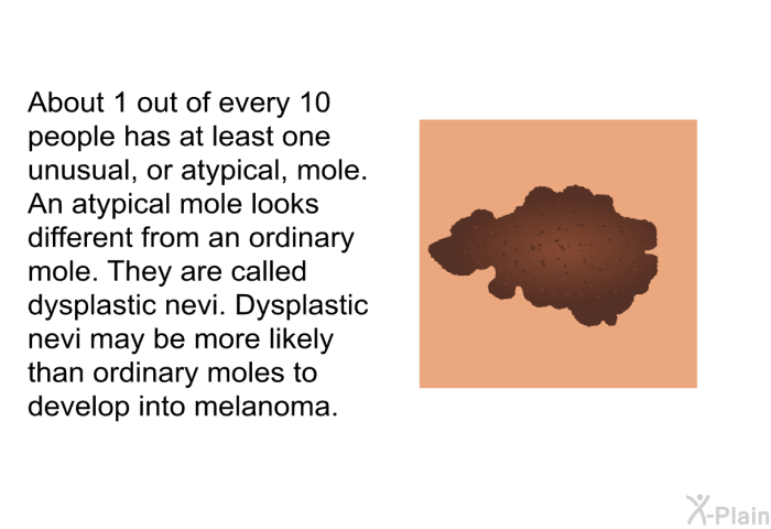 About 1 out of every 10 people has at least one unusual, or atypical, mole. An atypical mole looks different from an ordinary mole. They are called dysplastic nevi. Dysplastic nevi may be more likely than ordinary moles to develop into melanoma.