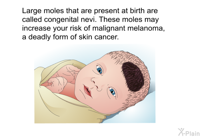Large moles that are present at birth are called congenital nevi. These moles may increase your risk of malignant melanoma, a deadly form of skin cancer.