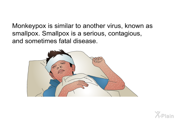 Monkeypox is similar to another virus, known as smallpox. Smallpox is a serious, contagious, and sometimes fatal disease.