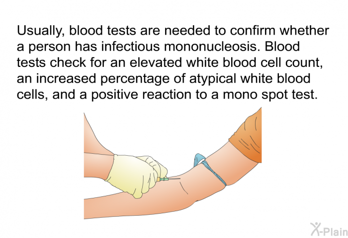 Usually, blood tests are needed to confirm whether a person has infectious mononucleosis. Blood tests check for an elevated white blood cell count, an increased percentage of atypical white blood cells, and a positive reaction to a <I>mono spot test</I>.