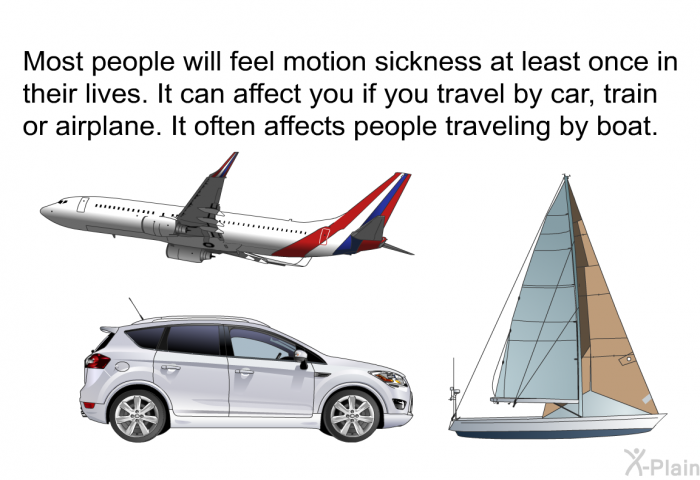 Most people will feel motion sickness at least once in their lives. It can affect you if you travel by car, train or airplane. It often affects people traveling by boat.