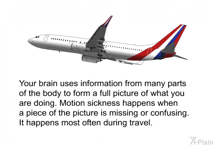 Your brain uses information from many parts of the body to form a full picture of what you are doing. Motion sickness happens when a piece of the picture is missing or confusing. It happens most often during travel.