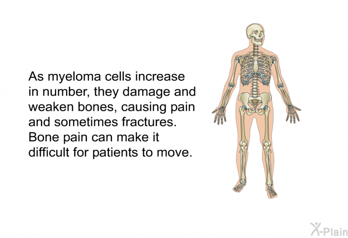 As myeloma cells increase in number, they damage and weaken bones, causing pain and sometimes fractures. Bone pain can make it difficult for patients to move.