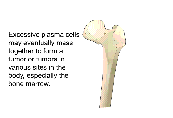 Excessive plasma cells may eventually mass together to form a tumor or tumors in various sites in the body, especially the bone marrow.