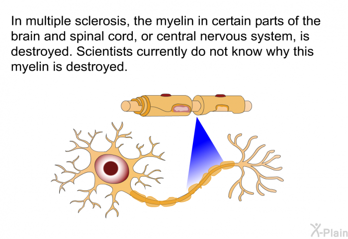 In multiple sclerosis, the myelin in certain parts of the brain and spinal cord, or central nervous system, is destroyed. Scientists currently do not know why this myelin is destroyed.