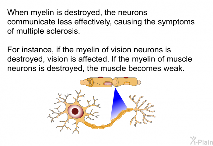 When myelin is destroyed, the neurons communicate less effectively, causing the symptoms of multiple sclerosis. For instance, if the myelin of vision neurons is destroyed, vision is affected. If the myelin of muscle neurons is destroyed, the muscle becomes weak.