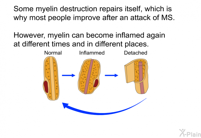 Some myelin destruction repairs itself, which is why most people improve after an attack of MS. However, myelin can become inflamed again at different times and in different places.