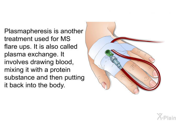 Plasmapheresis is another treatment used for MS flare ups. It is also called plasma exchange. It involves drawing blood, mixing it with a protein substance and then putting it back into the body.