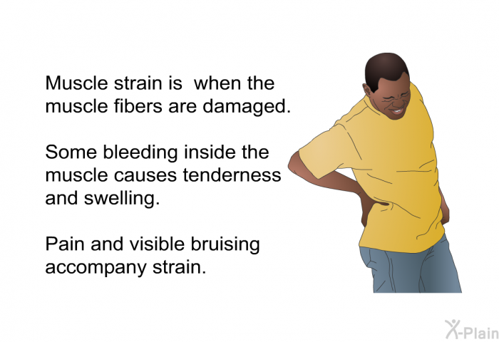 Muscle strain is when the muscle fibers are damaged. Some bleeding inside the muscle causes tenderness and swelling. Pain and visible bruising accompany strain.