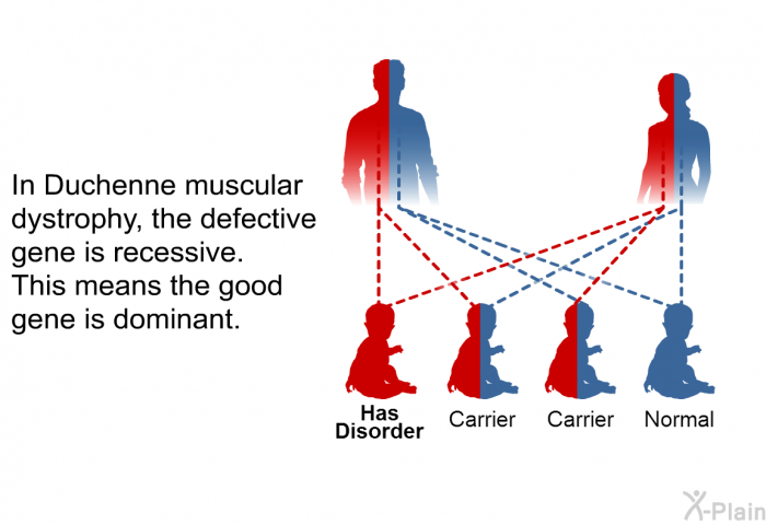 In Duchenne muscular dystrophy, the defective gene is recessive. This means the good gene is dominant.