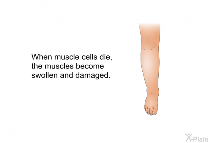 When muscle cells die, the muscles become swollen and damaged.