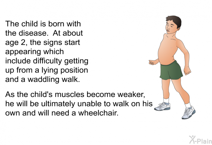 The child is born with the disease. At about age 2, the signs start appearing which include difficulty getting up from a lying position and a waddling walk. As the child's muscles become weaker, he will be ultimately unable to walk on his own and will need a wheelchair.