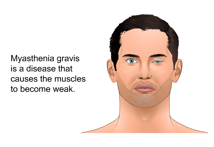 Myasthenia gravis is a disease that causes the muscles to become weak.
