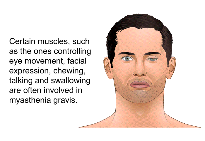 Certain muscles, such as the ones controlling eye movement, facial expression, chewing, talking and swallowing are often involved in myasthenia gravis.