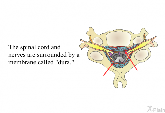 The spinal cord and nerves are surrounded by a membrane called "dura."